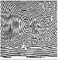 Central Pocket Loop Whorl Central Pocket Loop Whorl
