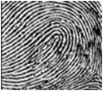 Radial Loop Radial Loop
